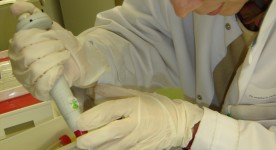 Working on a PCR with gel-electrophoresis