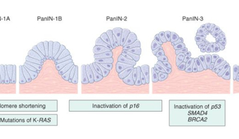 Preneoplastic lesions