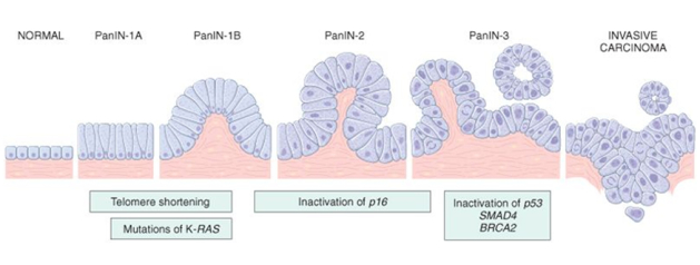 Preneoplastic lesions