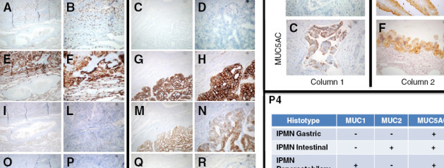 Press release and Twitter of our paper on PEAC for AIRC