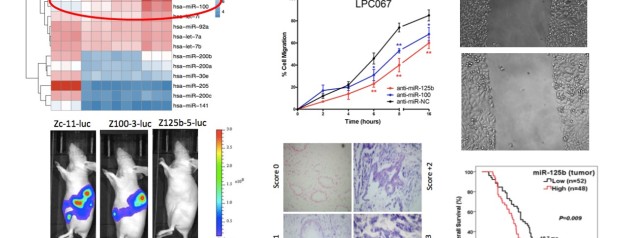 Key microRNAs controlling pancreatic cancer progression – our last collaborative study published in Nature Communications